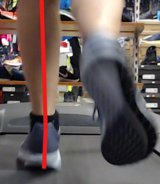 Neutral pronation